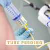 TUBE FEEDING