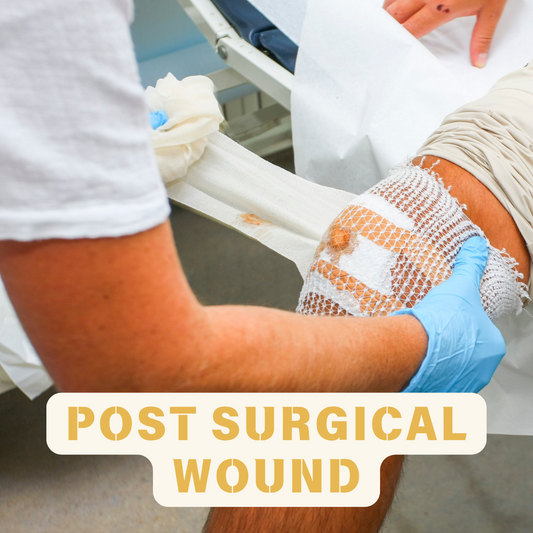 WOUND CARE MANAGEMENT